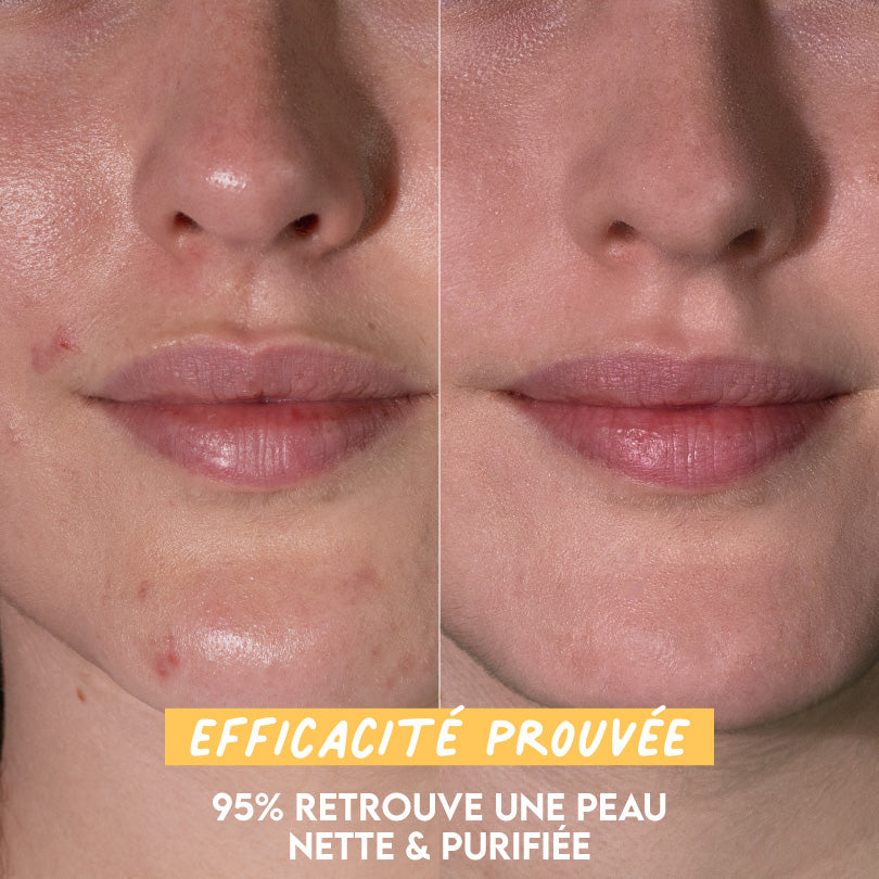 Lotion Purifiante