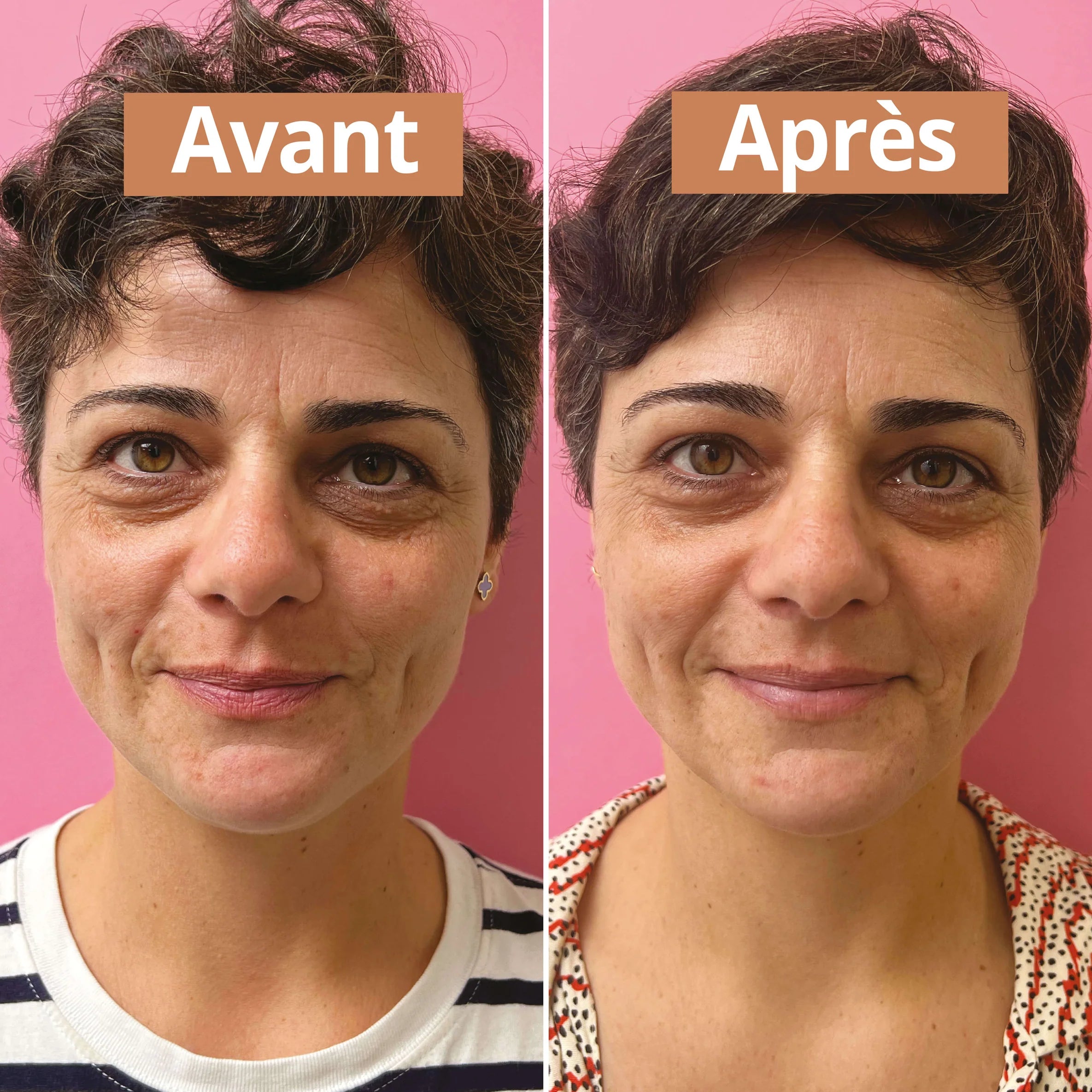 Sérum Visage Anti-Âge