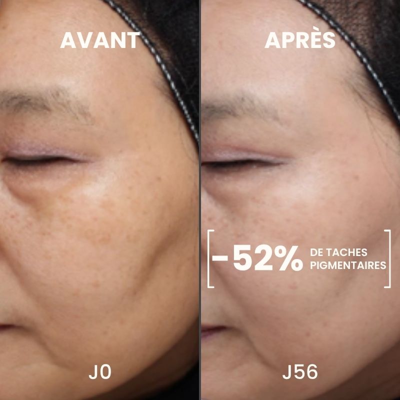 Soin Contour des Yeux Éclat