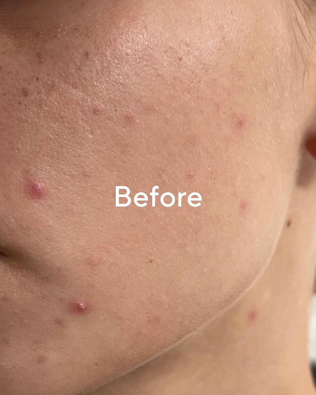 Sérum Retinol Alternative