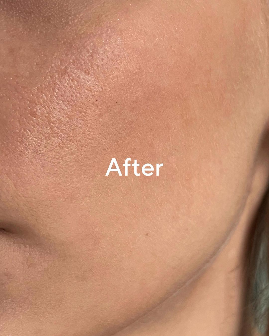 Sérum Retinol Alternative