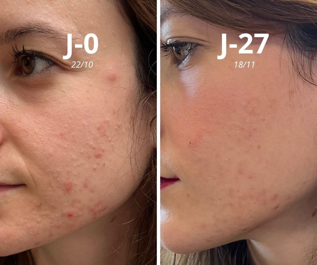 Sérum Visage Anti-Imperfections
