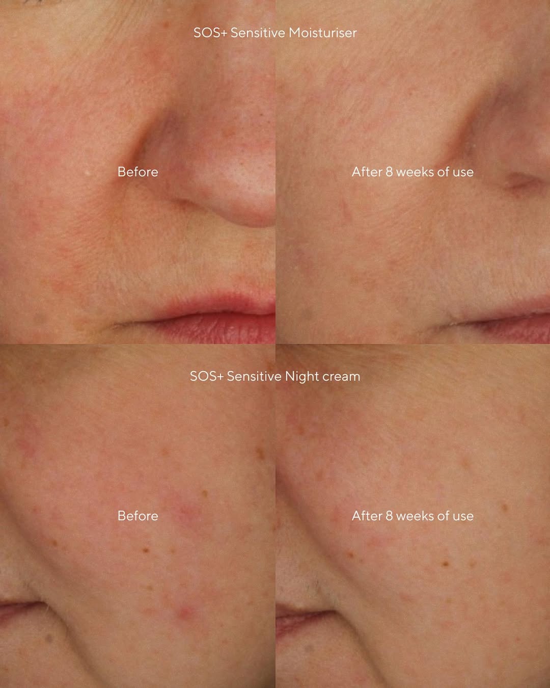 Crème de Nuit SOS+ Sensitive