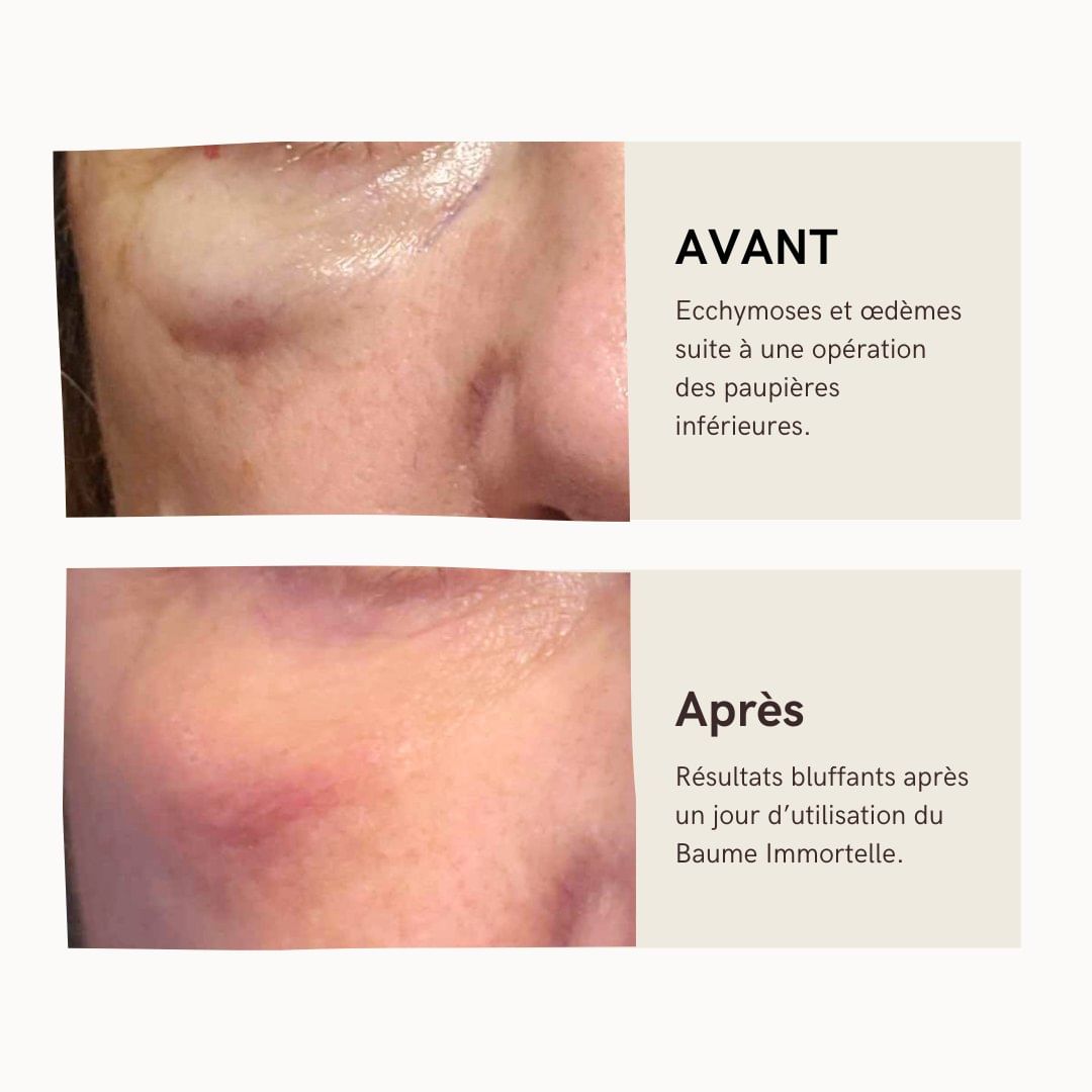 Baume Immortelle Concentré Réparateur