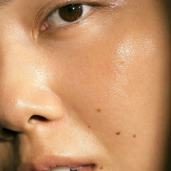 Masque PEEL à l&