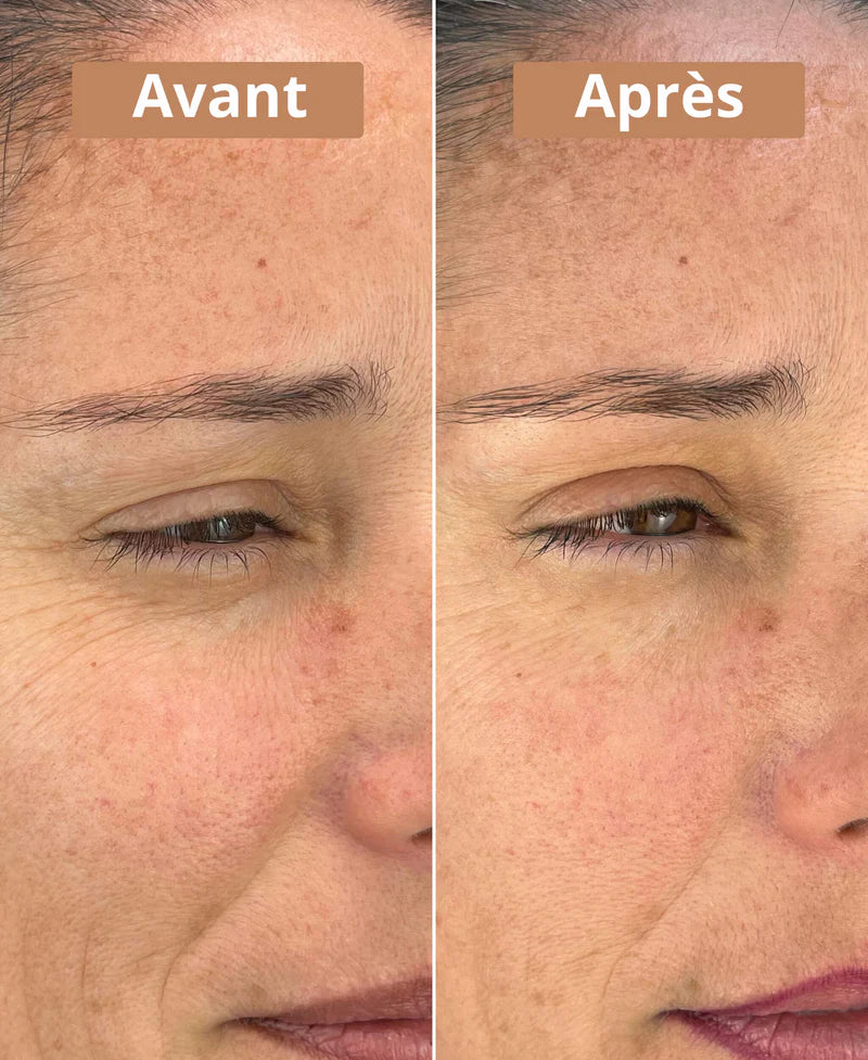 Sérum Contour Des Yeux